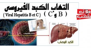 هل عجزت الدّولة عن معاجلة “البوصفّير”؟